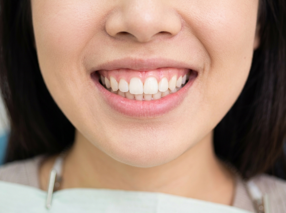 periodontal gallery 3
